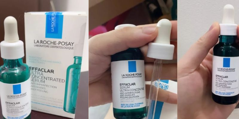 Serum trị thâm mụn hiệu quả phân loại xử lý